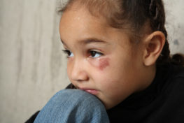 Texas Child Abuse Lawyer