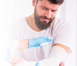 Injured man getting a cast