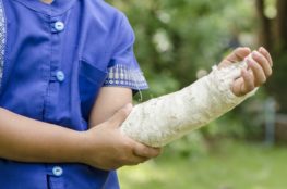 injured child holding his casted arm