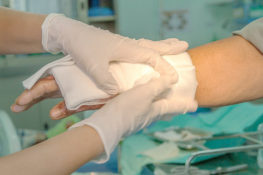 burned hand injury being cured