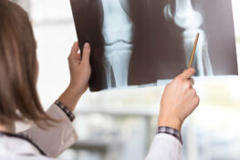 Compensacion laboral por lesion de rodilla
